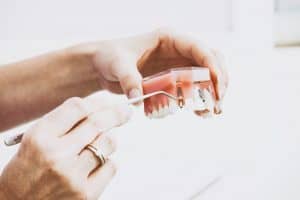 hand showing dental implant in model