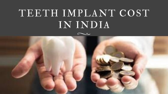 teeth implant cost in india