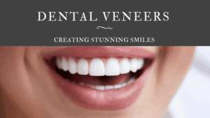 Dental Veneers for Smile Makeovers