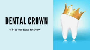 Dental Crown complete Guide