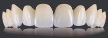 All ceramic dental crowns