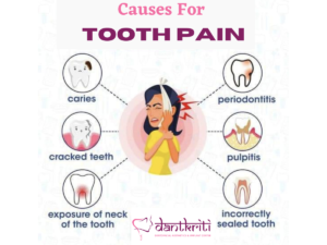 tooth pain causes and treatment
