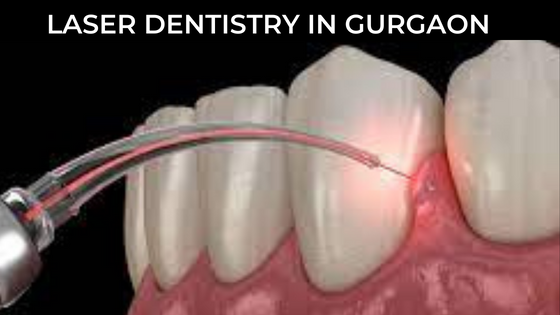 Laser Dentistry In Gurgaon India