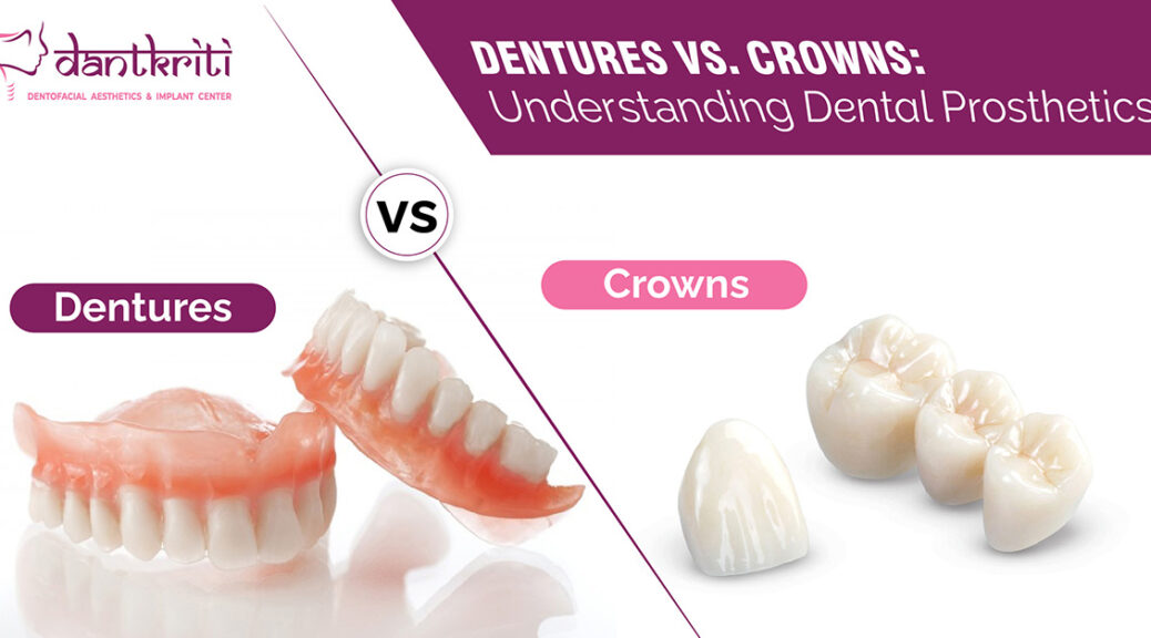 Dentures Vs Crowns