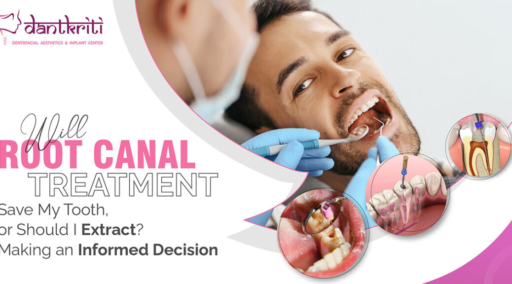 will root canal treatment save my tooth