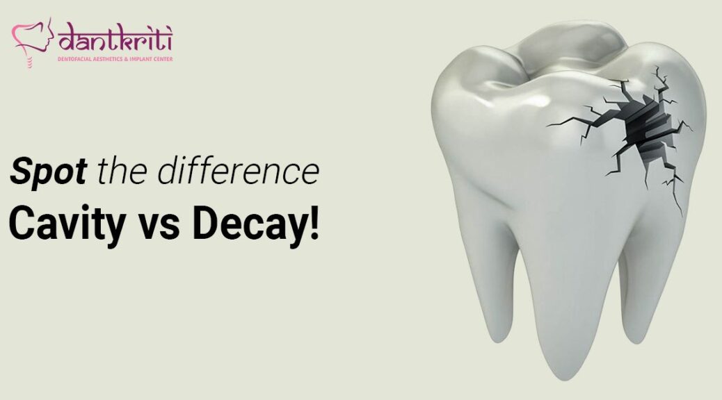 Tooth Decay Treatment