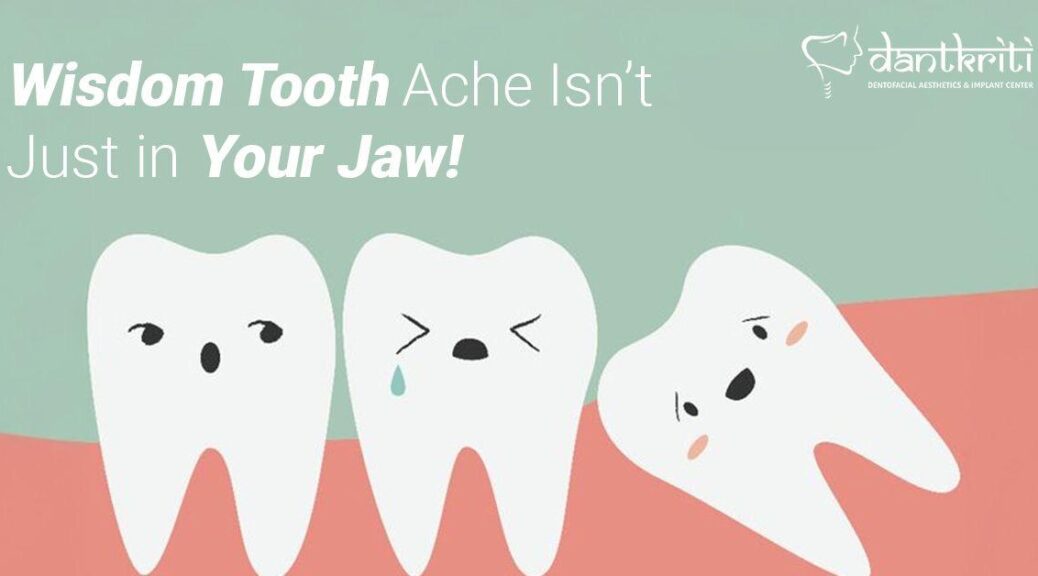 Wisdom Tooth ache isn't in your jaw