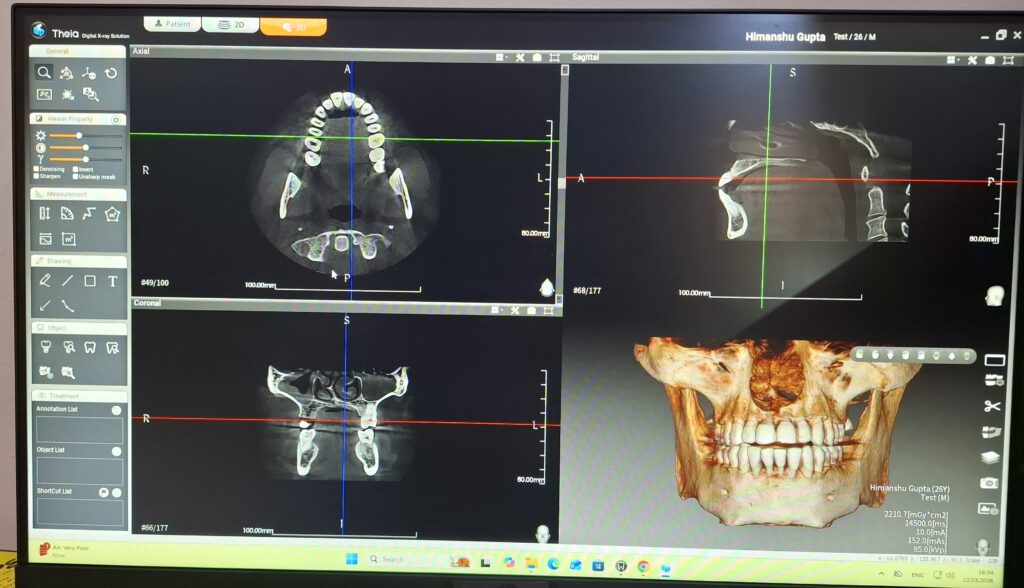 CBCT Images