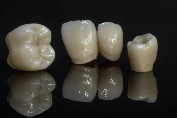 Crown And Bridge Treatment In Gurgaon Types Of Dental Crown